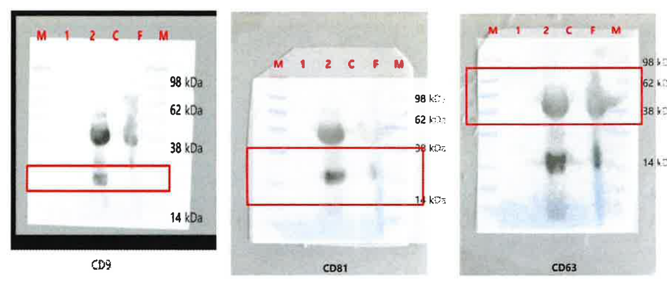 Original CD9 CD81 and CD63 Western blots