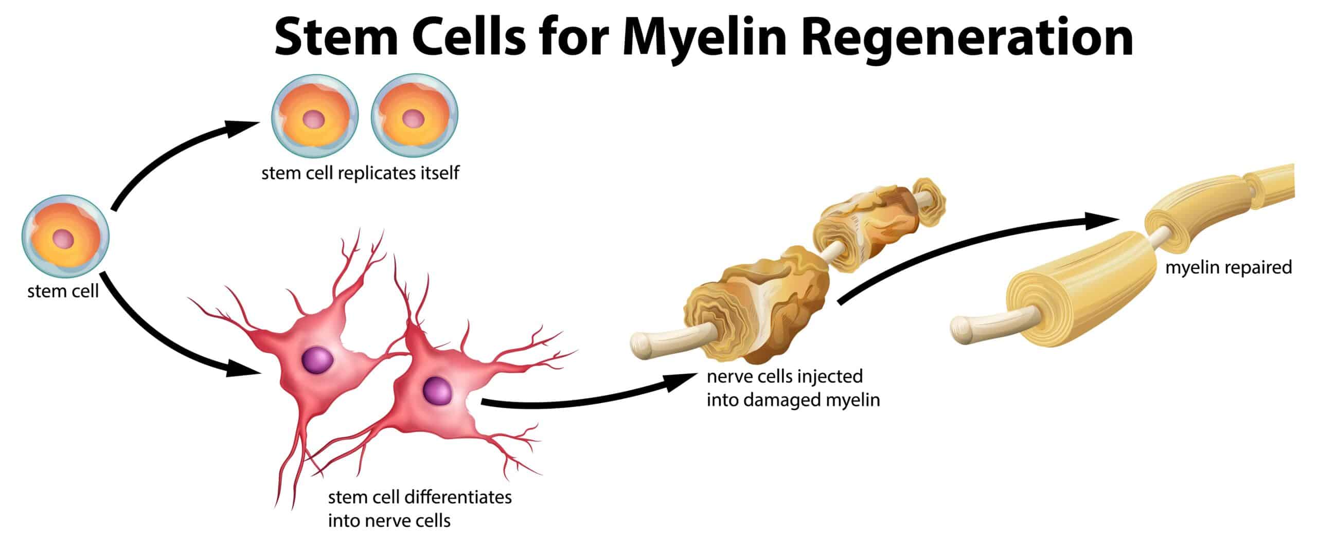 Future Potential of Bone Marrow's Exosomes